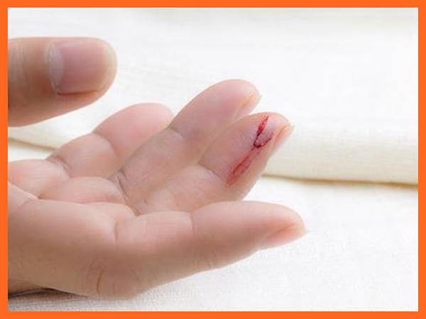 Mơ thấy đứt tay là điềm báo hung hay cát? Đánh con gì Mơ thấy đứt tay là điềm báo hung hay cát? Đánh con gì